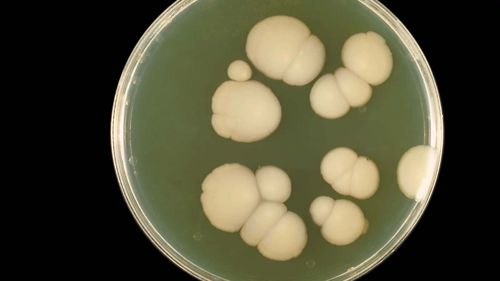 A laboratory culture plate showing cream-coloured fungal colonies on agar